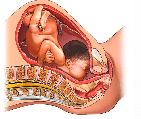 posición del feto